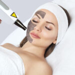 Carbon face peeling procedure in a beauty salon. Hardware cosmetology treatment.