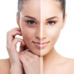 пилинг-в-ульяновске-2